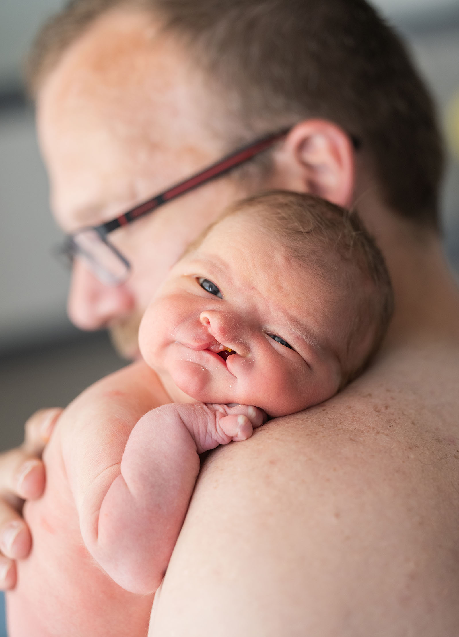 baby walker - flinders medical center newborn photography 9 Newborn with cleft lip in tender embrace, fostering love, care, and security with caregiver.